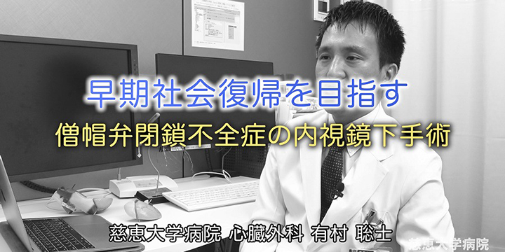 僧帽弁閉鎖不全症の内視鏡下手術 専門医紹介動画 #006