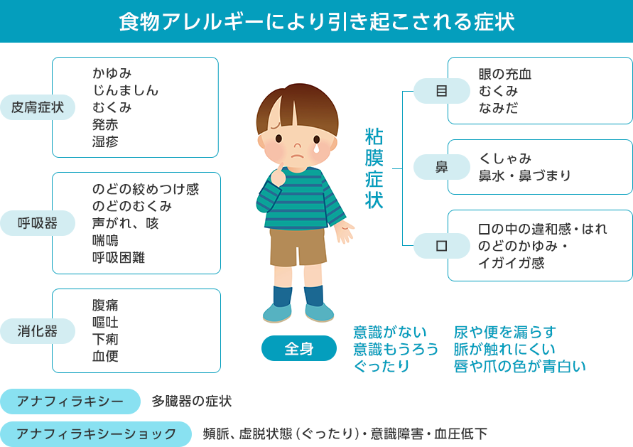 アレルギー外来 診療科 部門一覧 東京慈恵会医科大学附属病院